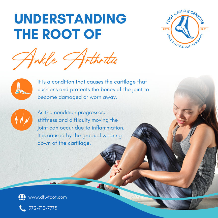 Understanding the Root Cause of Ankle Arthritis Foot & Ankle Centers