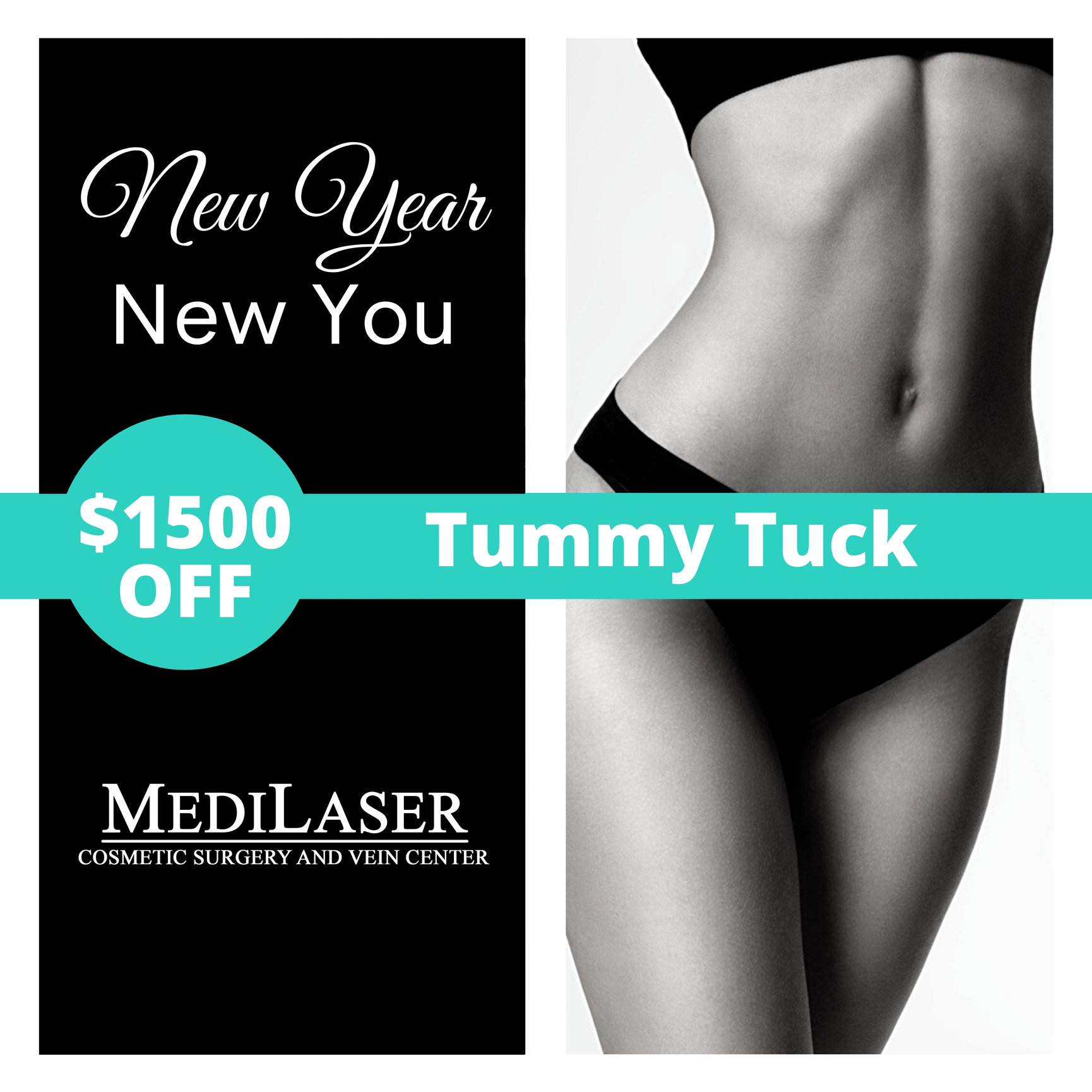 New Year, New You With A Tummy Tuck! - Medilaser Surgery and Vein Center